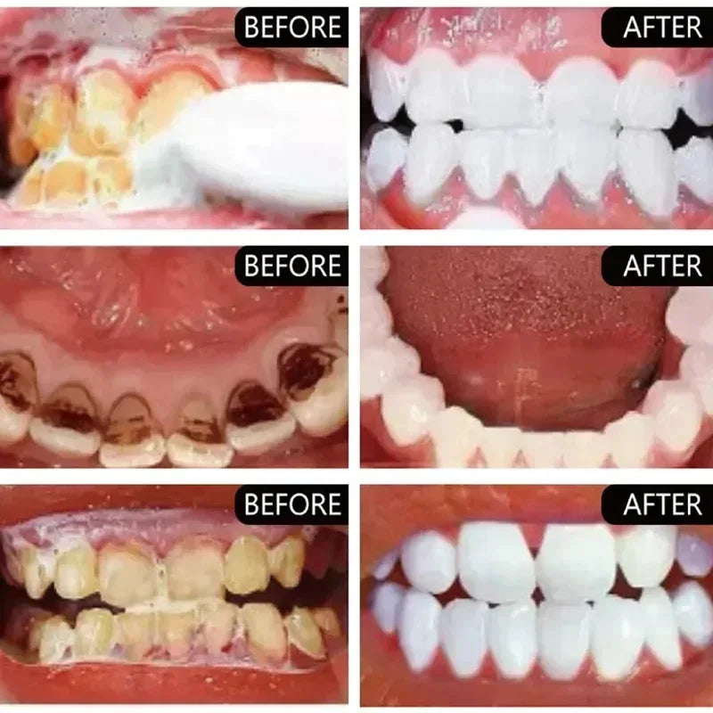 V34 Purple Teeth Whitening Toothpaste Remove Plaque Stains Cleaning Oral Hygiene Dental Bleach Tools Fresh Breath Beauty Health