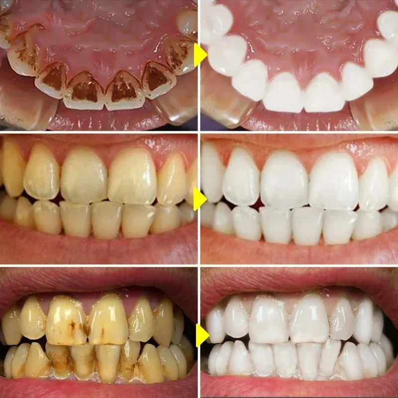 V34 Purple Teeth Whitening Toothpaste Remove Plaque Stains Cleaning Oral Hygiene Dental Bleach Tools Fresh Breath Beauty Health
